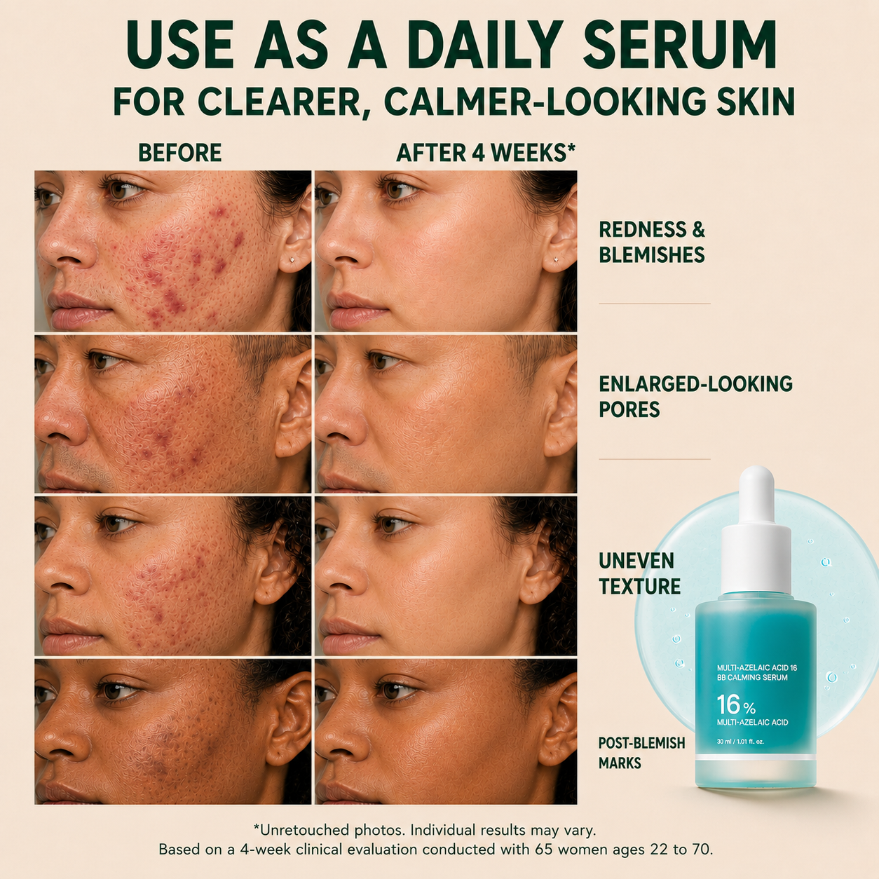 Anchoic Acid Soothing Serum